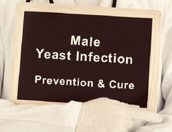 Ways Men Can Be Free From Yeast Infections
